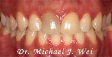 delores smile before