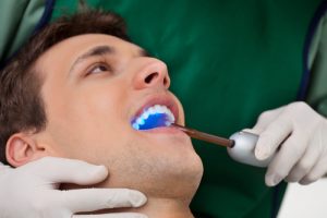 dental bonding treatment