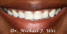 jaemy c smile before