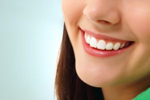 prepless veneers