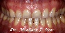 case 64 before