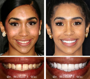 Cosmetic Dentist in Manhattan - perfect smile makeovers