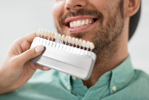 Veneer Tooth Color Chart