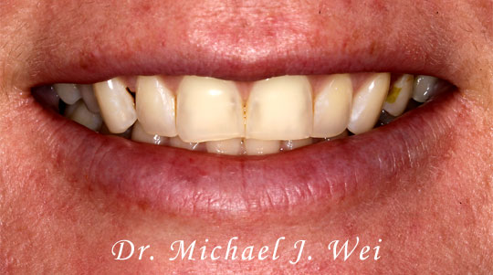 Smile Gallery - cosmetic dentist before after photos smile ...