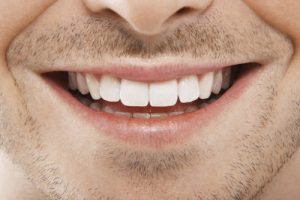 dr michael j. wei award smile makeover