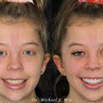 Laura T smile makeover Dr Michael J Wei