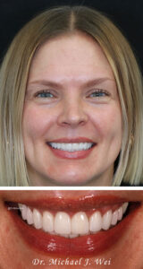 Helena R Composite After