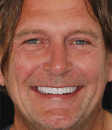 Rido D Face After Smile Makeover 220x256