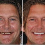 rido smile makeover full-mouth reconstruction dr michael j wei