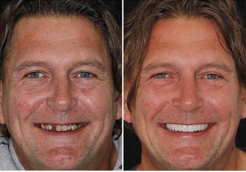 rido smile makeover full-mouth reconstruction dr michael j wei