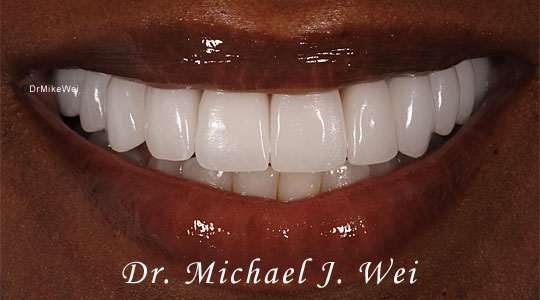 Antonia D Smile After Smile Makeover 540x300