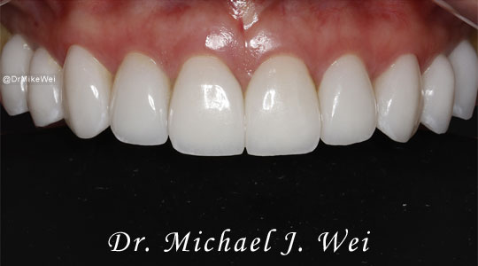 Smile Gallery Cosmetic Dentist Before After Photos Smile Dentist In