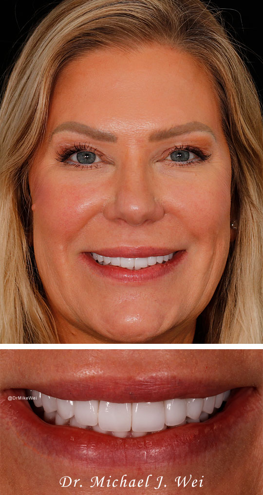 Smile Gallery after photo