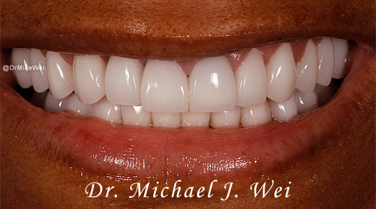 Tanasha B Smile After Smile Makeover 540x300