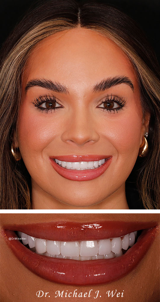 Smile Gallery after photo