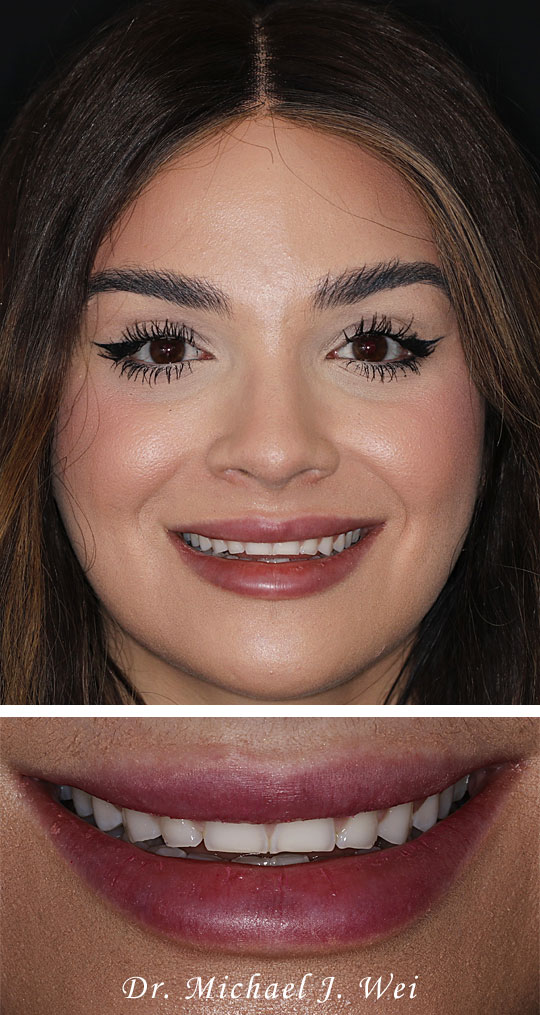 Smile Gallery before photo