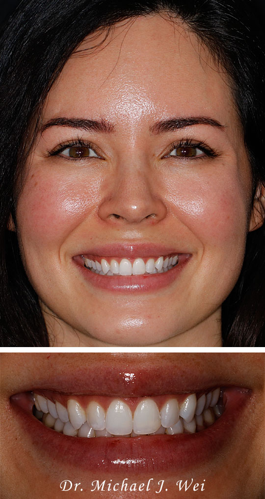 Smile Gallery before photo