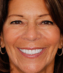 Lisa M Face After 220x256B