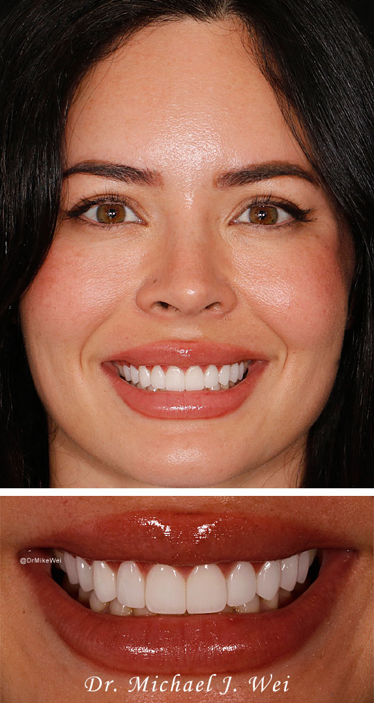 Smile Gallery after photo